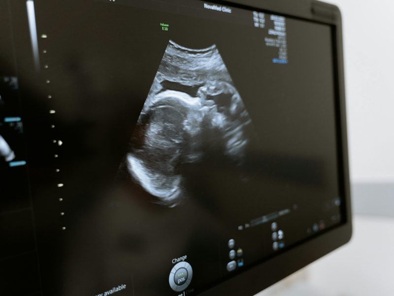 سونار بشري Edan dus60 سونار ultrasound ايدان